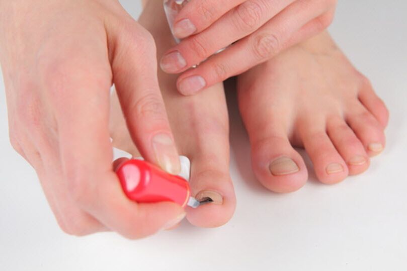 Foot mushroom prevention