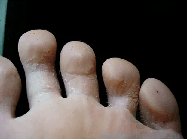 The phases of the mushroom